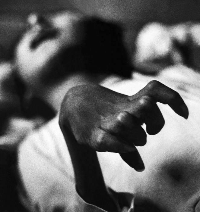 W. Eugene: Smith „Ligos auka, iškraipyta ranka“. Minamata, Japonija 1971.